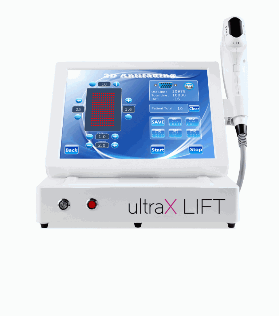 ultrax lift kvalita